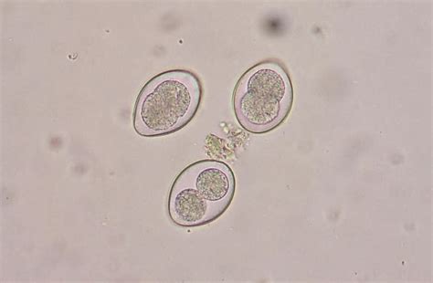 Cryptosporidium and Coccidia Exam, Fecal